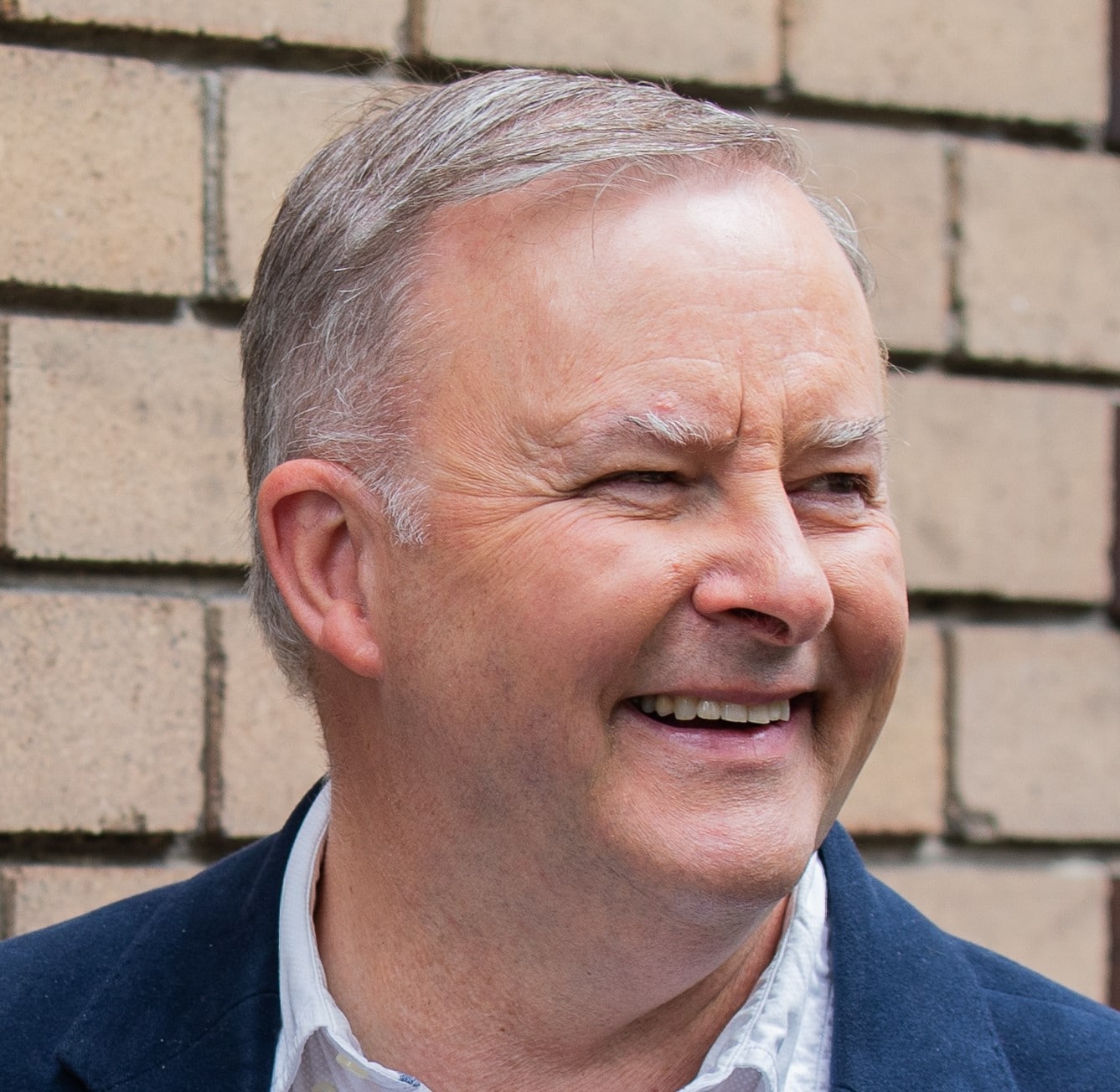 Anthony Albanese