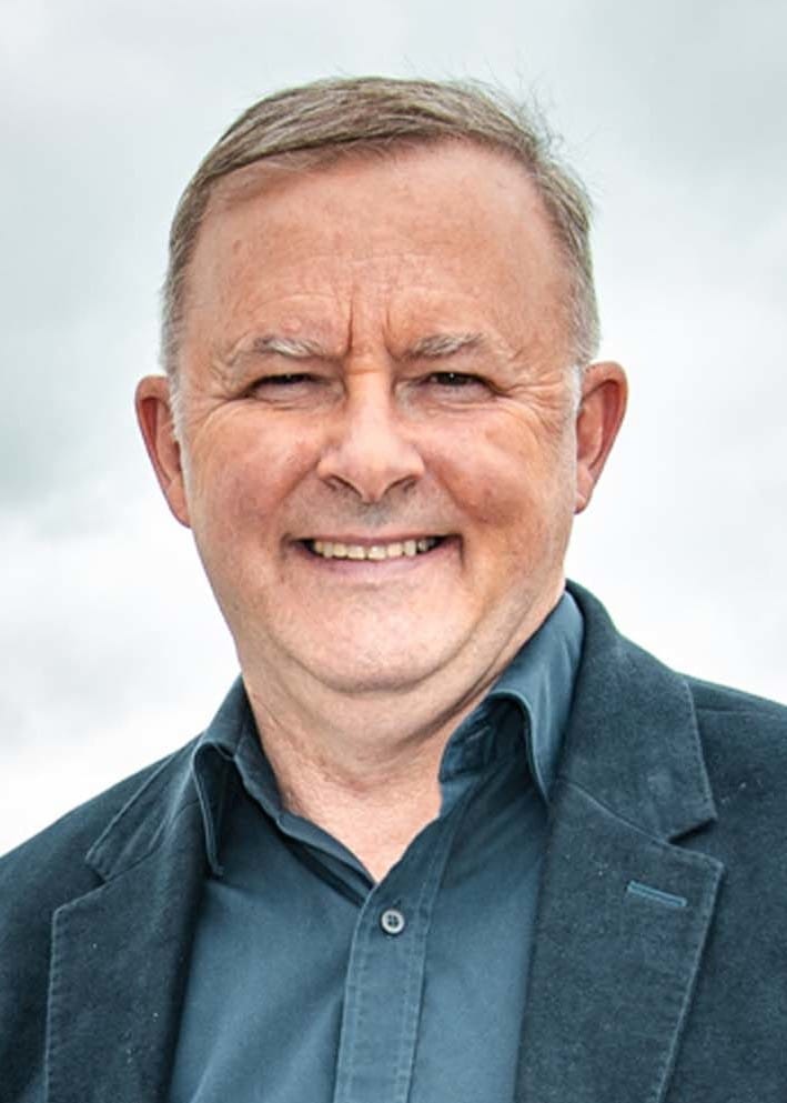 Anthony Albanese