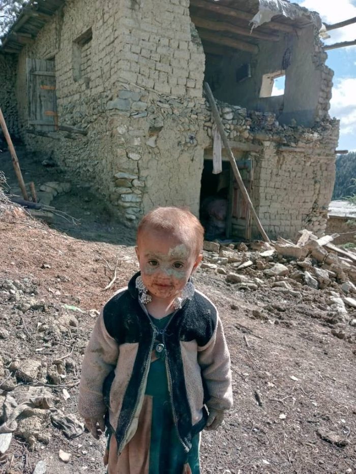 Child who survived Afghan earthquake