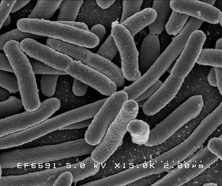 E Coli is a common antibiotic resistant bacteria of concern.