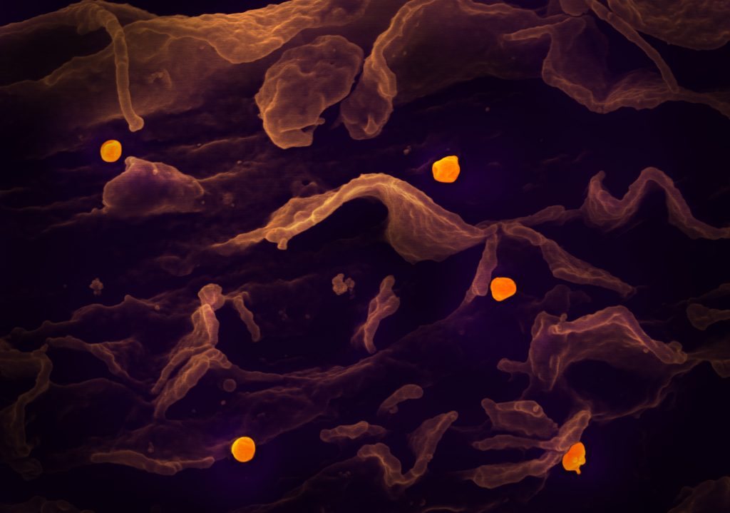 Micrograph shows the formation of the Nipah virus in a cell.