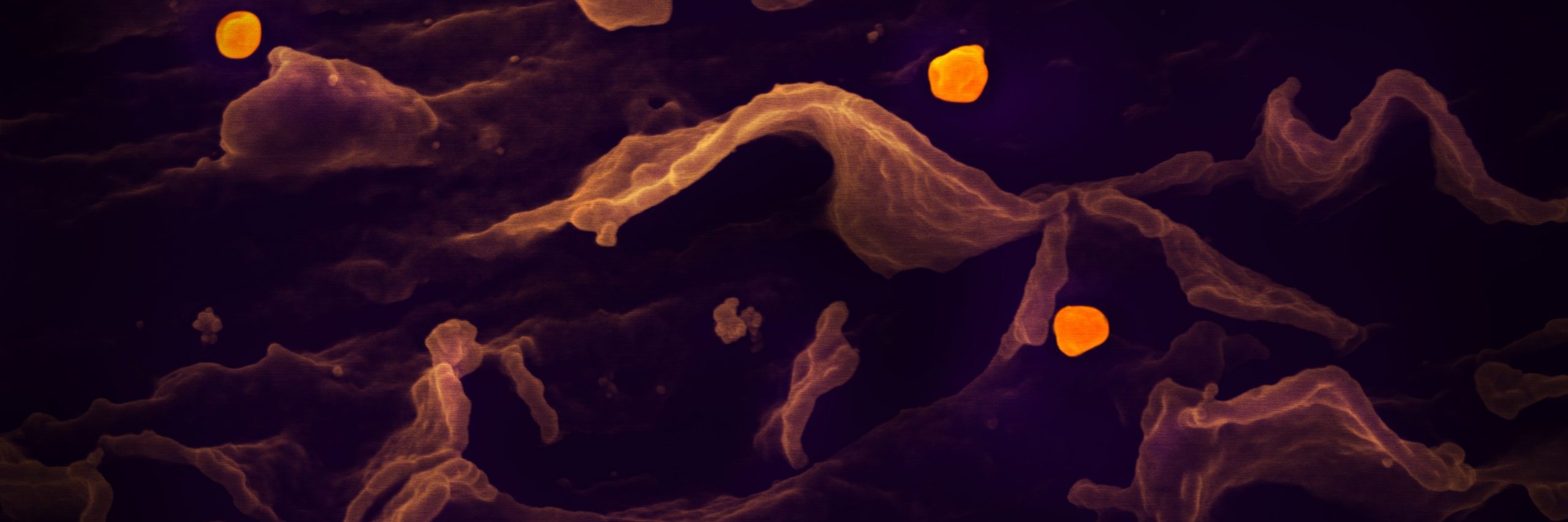 Micrograph shows the formation of the Nipah virus in a cell.