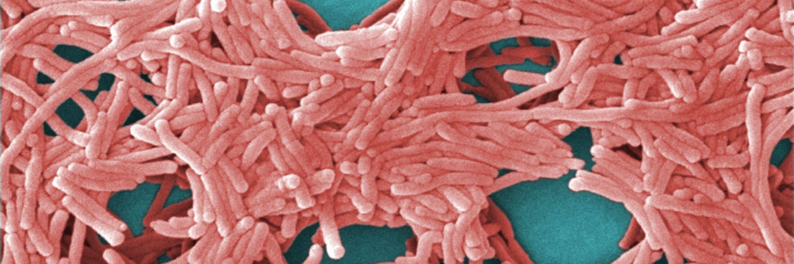 An image of a colorised scanning electron micrograph with moderately-high magnification of 5000X, depicting a large grouping of Gram-negative Legionella pneumophila bacteria, the most common type of Legionella bacteria that causes Legionnaires' disease. Image source: Janice Haney Carr, via Wikimedia Commons